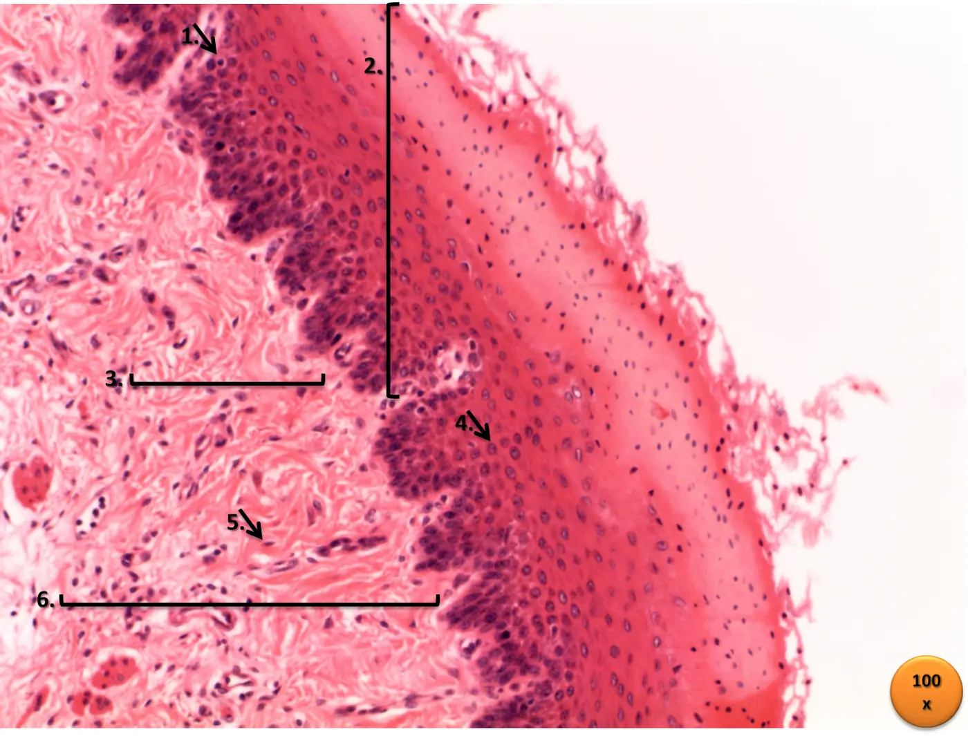 Micrografia in ematossilina-eosina della mucosa dell'esofago a 100 ingrandimenti, con numeri da 1 a 6: a destra un epitelio a molti strati con cellule basali scure e cellule superficiali appiattite che conservano il nucleo, a sinistra un connettivo rosa con fibroblasti e piccoli vasi