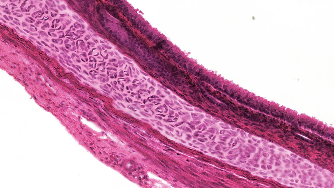 Micrografia in ematossilina-eosina della parete della trachea: in alto a destra il lume vuoto e un epitelio cilindrico con ciglia e nuclei a diverse altezze, sotto una fascia di connettivo, al centro un anello di cartilagine con condrociti nelle lacune immersi in una matrice omogenea, in basso a sinistra il connettivo esterno