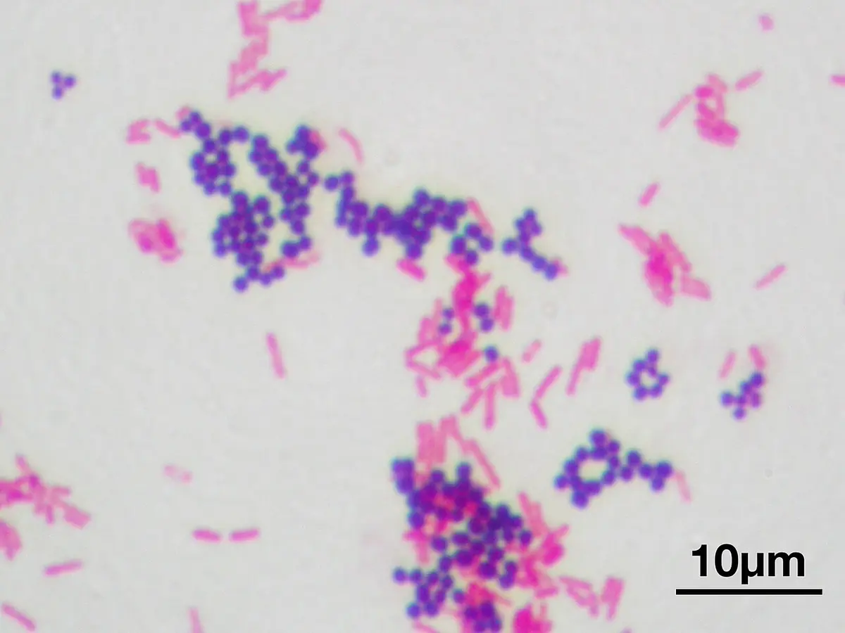 Vetrino con colorazione di Gram a 1000 ingrandimenti: cocchi viola raccolti in grappoli e bastoncelli rosa sparsi sullo sfondo chiaro