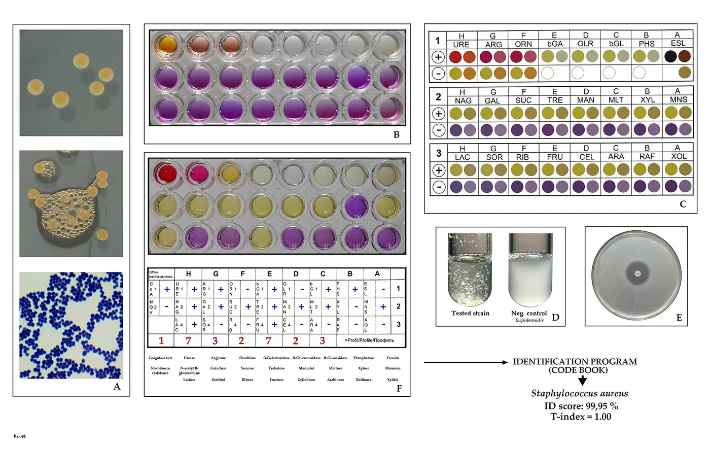 Tavola dei test di laboratorio per identificare Staphylococcus aureus: colonie pigmentate, prova della catalasi con bolle, cocchi viola al Gram, piastra di test biochimici colorati, provetta della coagulasi con plasma coagulato accanto al controllo negativo, disco di novobiocina su piastra